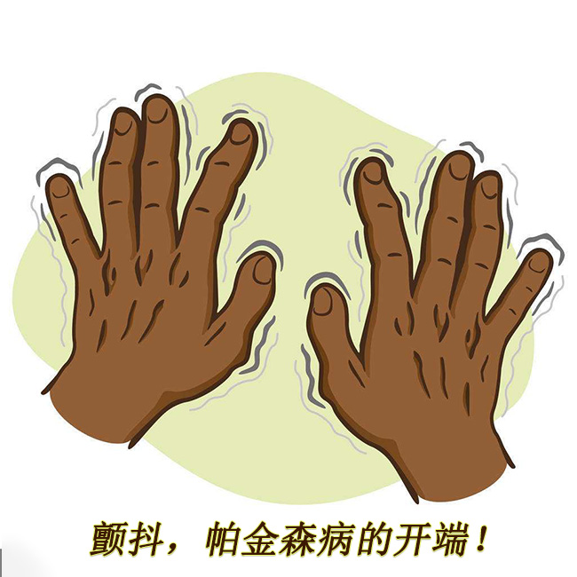 顫抖，帕金森病的開(kāi)端 帕金森的早期癥狀